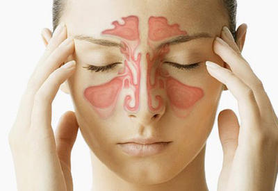 Что делать, если заложен нос: 7 средств, которые быстро помогут