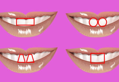 Теперь эгоиста можно раскусить в два счета. Нужно просто взглянуть на его зубы <span class="color_red">- 4 ФОТО</span>