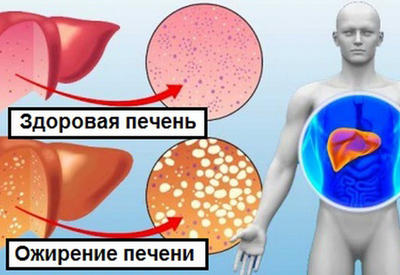 10 продуктов, которые можно включить в диету, чтобы очистить печень