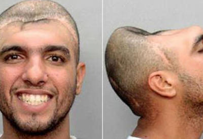 Самые невероятные травмы - 8 ФОТО