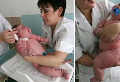 250-килограммовая женщина родила ребенка. Как думаете, сколько он весит?