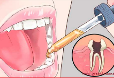 Положите это в рот и зубная боль исчезнет в течение нескольких секунд!