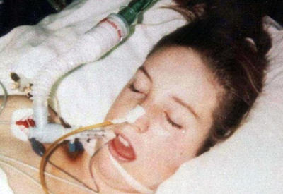 Вот к чему может привести всего одна таблетка экстази <span class="color_red"> -  2 ФОТО</span>