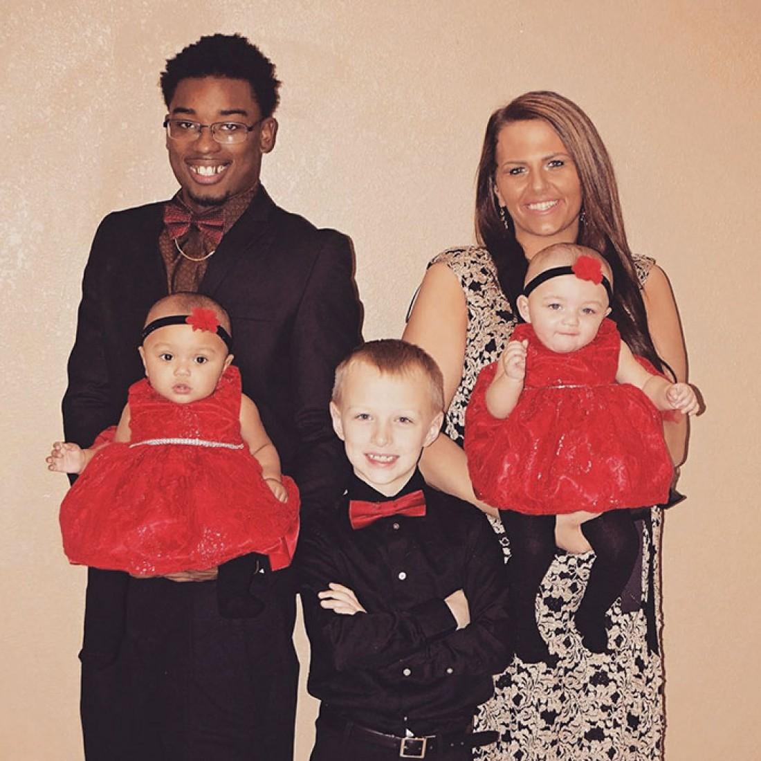 В США родились близнецы с разным цветом кожи