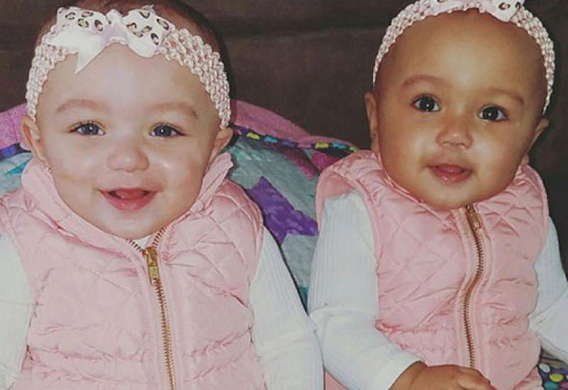 В США родились близнецы с разным цветом кожи