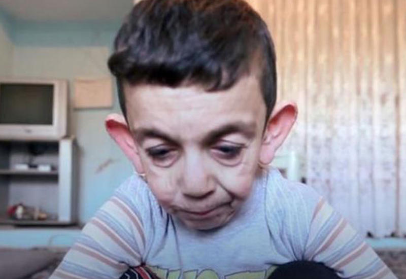 7 yaşlı Məhəmməd: "Evdəki bütün güzgüləri yığışdırın"