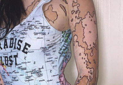 Люди издевались над ней из-за витилиго. Но она превратила свою болезнь в искусство!