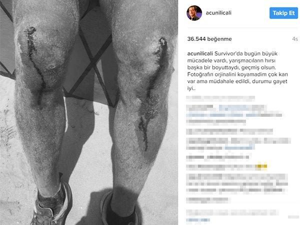 "Survivor"dan qorxulu görüntü