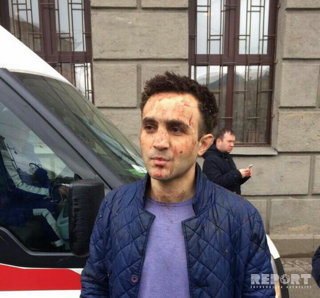 Раненый в петербургском теракте азербайджанец рассказал, как вел себя смертник