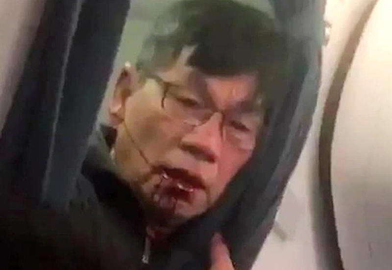 Адвокаты пассажира United Airlines готовятся вытрясти из авиакомпании солидную компенсацию