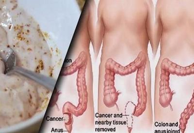 Эти два ингредиента выведут из толстой кишки килограммы токсинов!