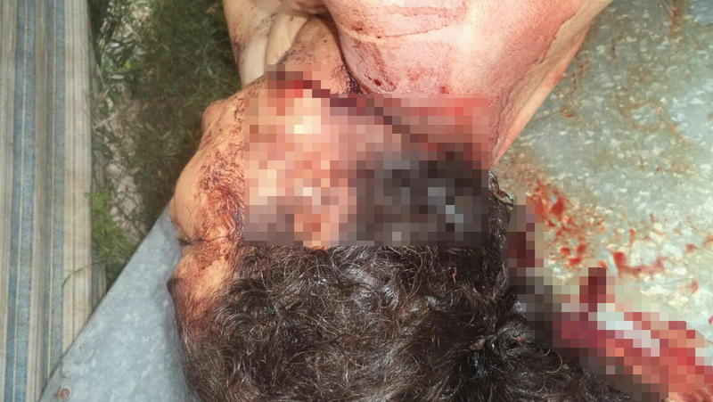 Фотофакты армянских зверств в отношении мирных азербайджанцев (18+)