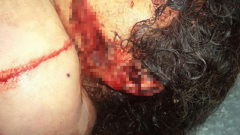 Фотофакты армянских зверств в отношении мирных азербайджанцев (18+)