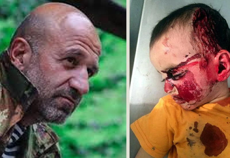 Вовочка Вартанов и девочка Захра: в Армении гордятся убийством азербайджанского ребенка