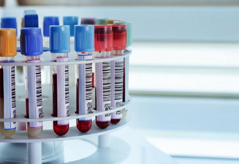 Xərçəngin ilkin əlamətlərindən əvvəl onu aşkar etməyə imkan verən test hazırlanıb