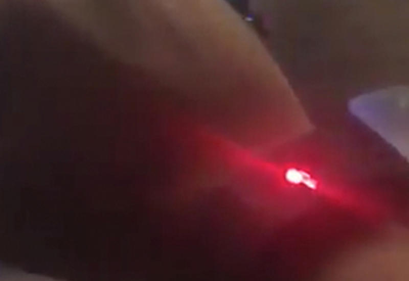 Журналист позволил каждому в интернете ударить его током и пожалел об этом