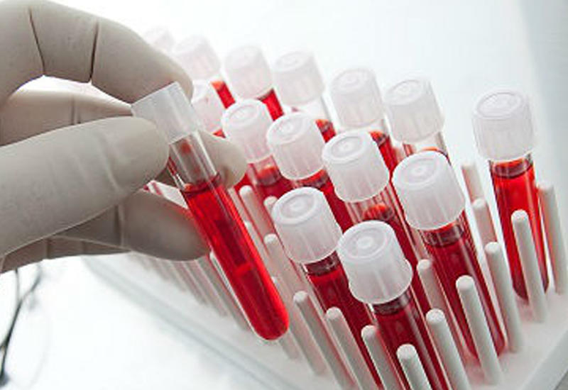 Учёные разработали метод звукового анализа крови