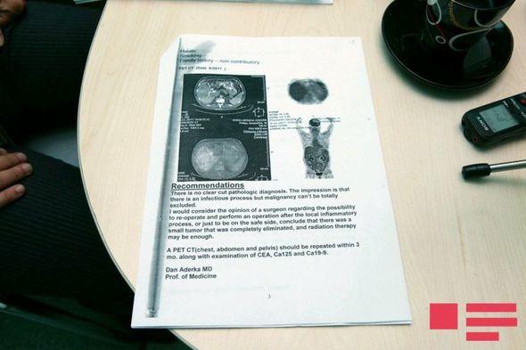“Faytonçu” Nazimin məhkəməyə verdiyi cərrah: "Mənim etdiyim əməliyyat nəticəsində yaşayır"