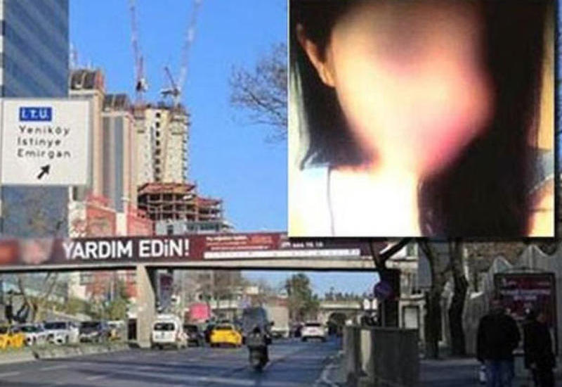 Universitetin önündə əcnəbi tələbəyə təcavüz etdilər