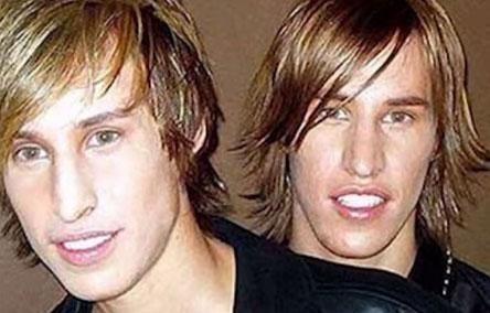 Близнецы заплатили 1 млн., чтобы выглядеть как Бред Питт, но у них не получилось