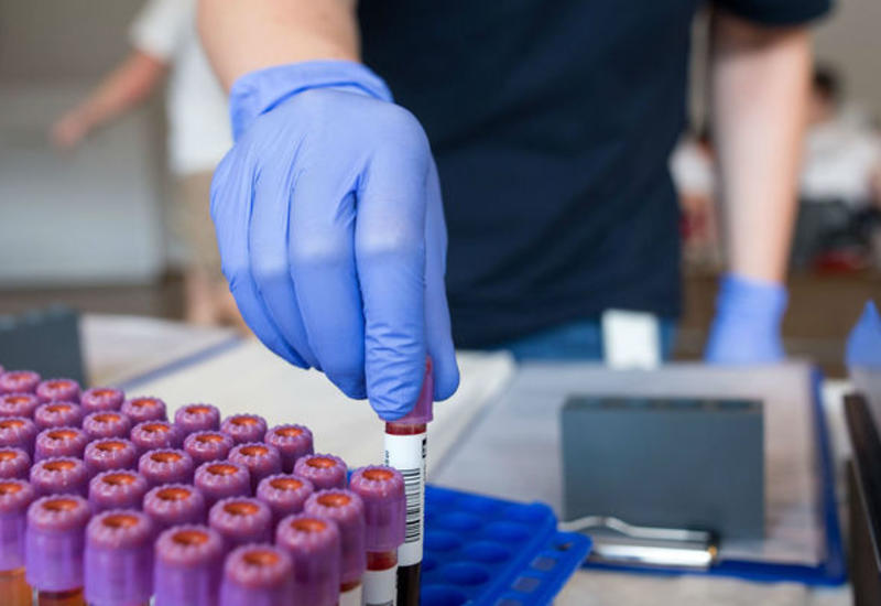 Разработан ДНК-тест, диагностирующий смертельный рак груди на ранней стадии