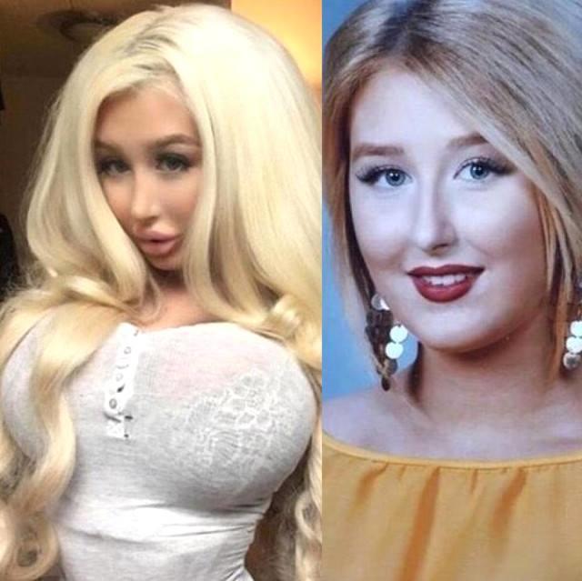 Barbi kuklaya bənzəmək üçün bunu da etdi