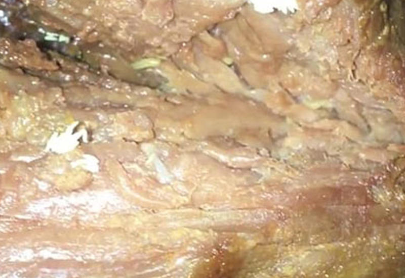 Вкусный ужин обернулся для супругов настоящим кошмаром