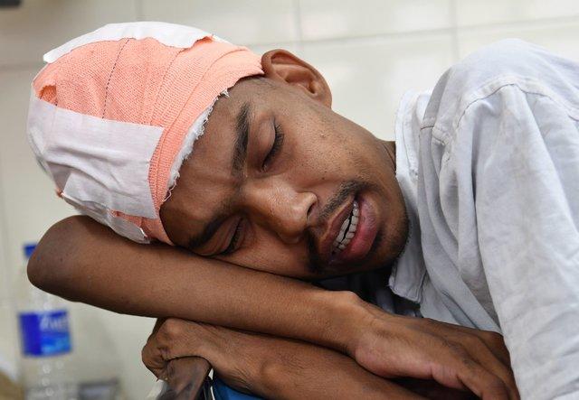 В Индии удалили самую большую в мире опухоль мозга весом почти 2 кг