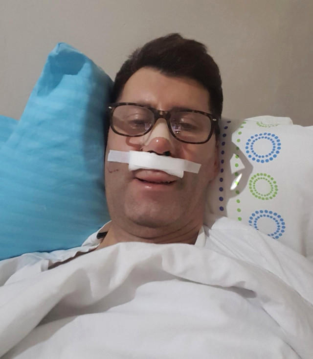 Tanınmış aktyor bədbəxt hadisənin qurbanı oldu - Dad və qoxu hissiyatını itirdi