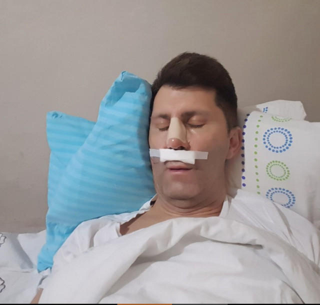 Tanınmış aktyor bədbəxt hadisənin qurbanı oldu - Dad və qoxu hissiyatını itirdi