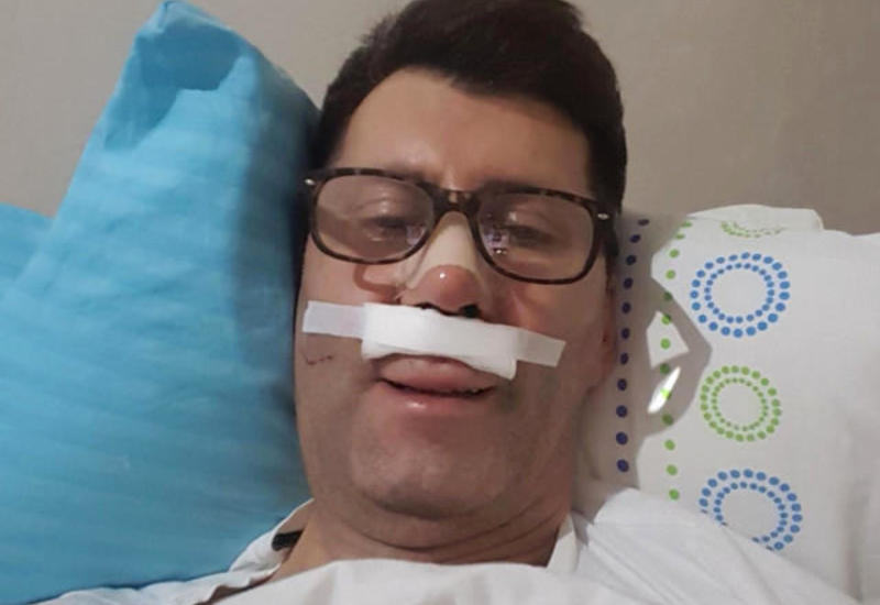 Tanınmış aktyor bədbəxt hadisənin qurbanı oldu - Dad və qoxu hissiyatını itirdi