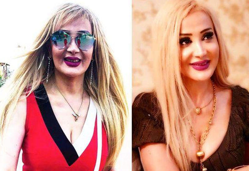 “Qalmaqala getsəm, gözəlliyim qalmaz”