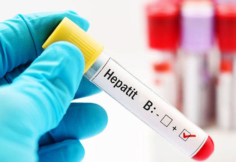 Xroniki hepatit
