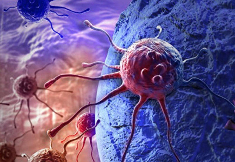Xərçəngin əsas səbəbi açıqlandı: 30 illik araşdırma