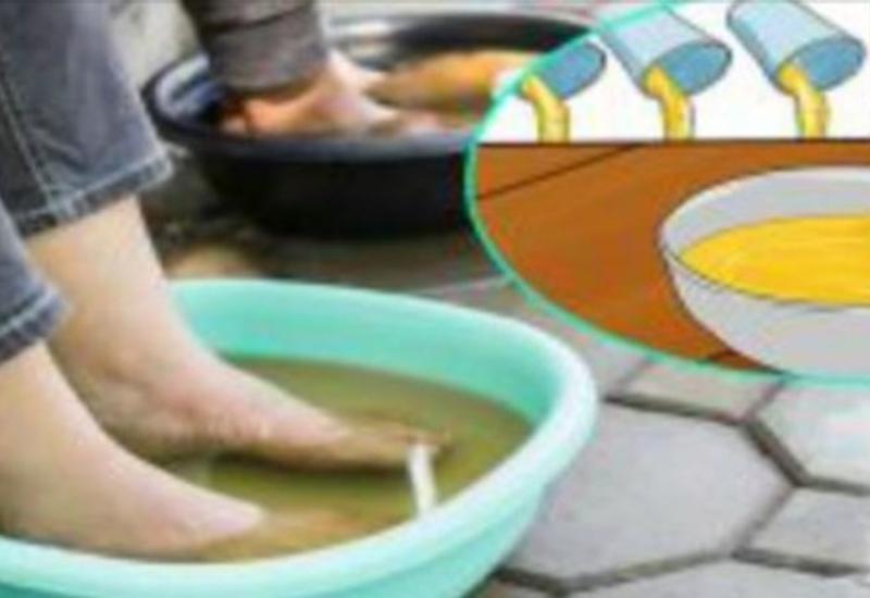 Möcüzəvi sirkə vannası