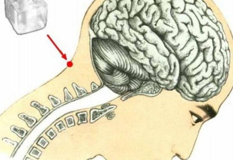 Boyundakı bu çökəyə buz qoyun, 10 yaş cavanlaşın