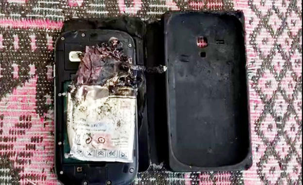 Telefon cibində partladı, xəstəxanalıq oldu