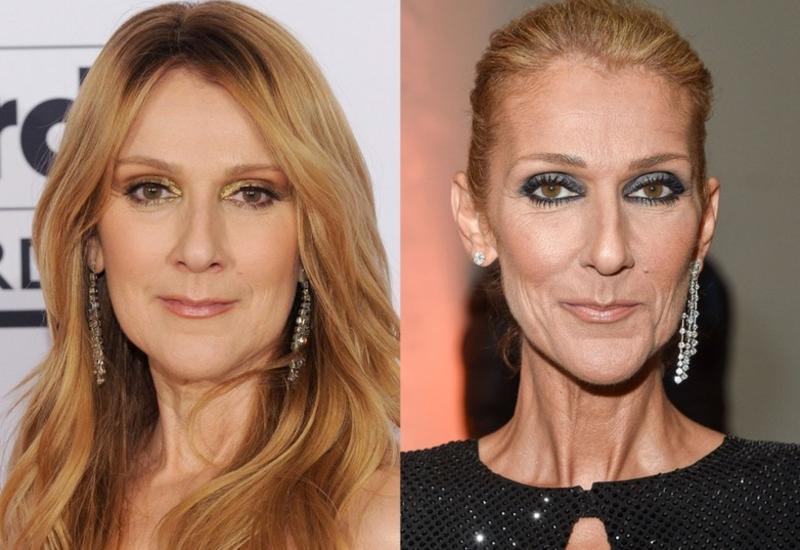 6 звезд, которые после похудения выглядят старше своих лет