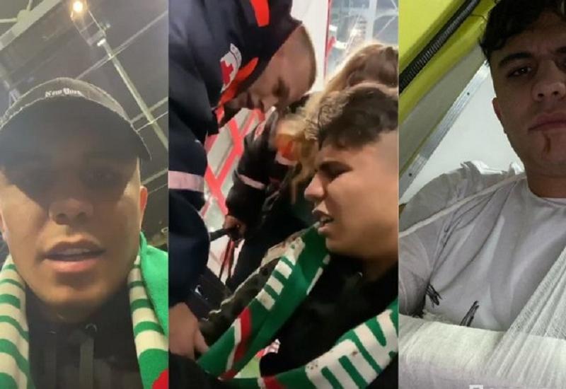 Азербайджанец сломал руку, пытаясь выбежать на поле в ходе матча Лиги чемпионов