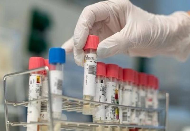 В Азербайджане названо количество проведенных тестов на коронавирус