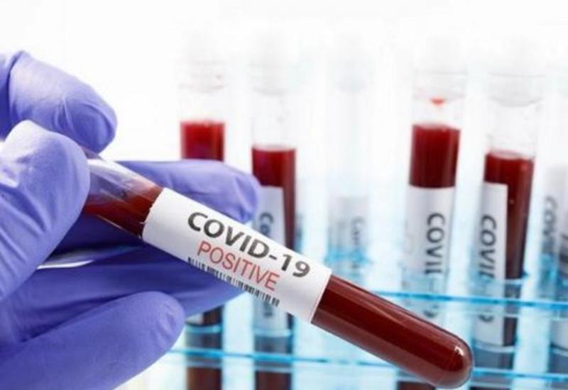 За сутки в Армении COVID-19 заразились 2 213 человек