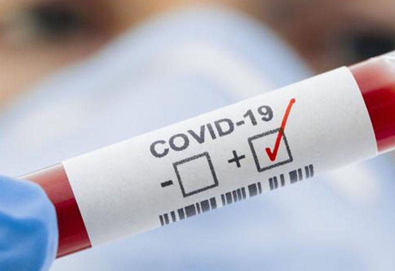 Число случаев COVID-19 в мире превысило 1 млн
