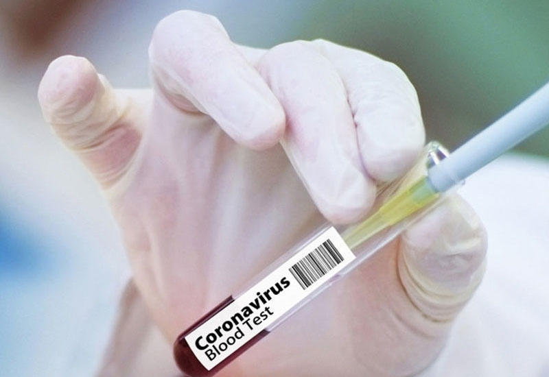 Alimlər: "Koronavirus isti ölkələrdə daha yavaş yayılır"