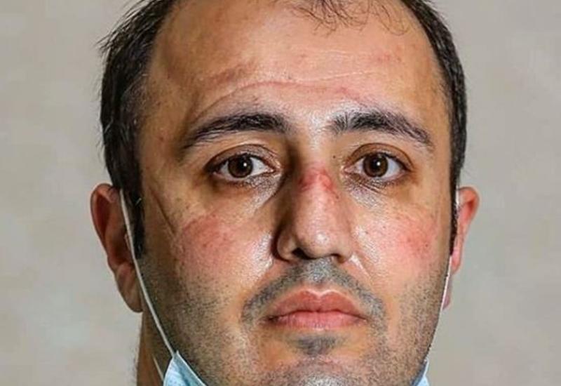 Müğənni Eldar Qasımov koronavirusla mübarizə aparan həkimlərə təşəkkür etdi