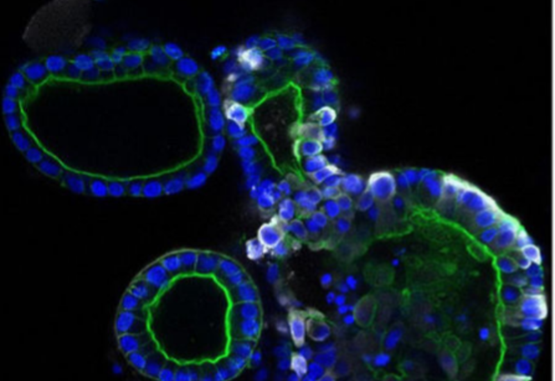 Koronavirus belə çoxalır