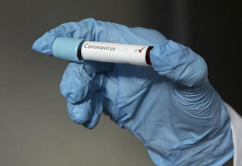 Число жертв коронавируса в мире превысило 530 тысяч