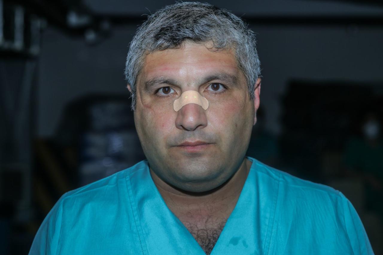 Герои в белых халатах: азербайджанские врачи, борющиеся с коронавирусом