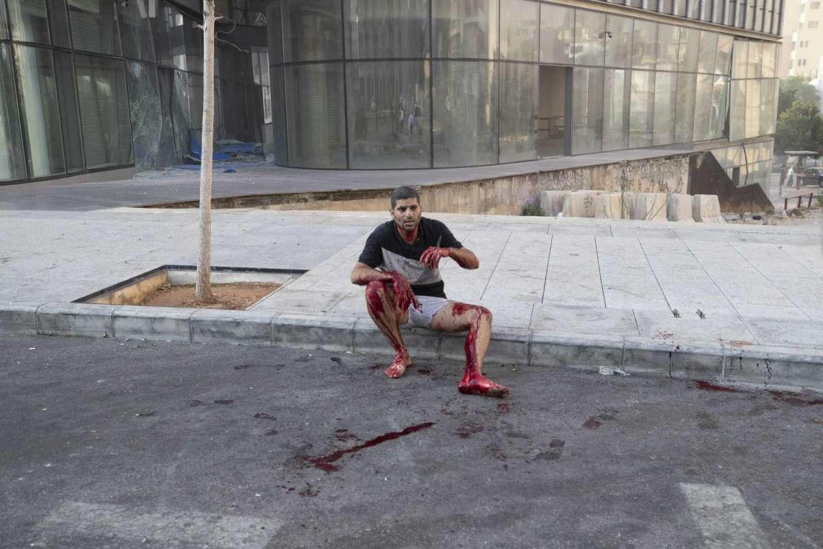 В Бейруте прогремел мощный взрыв, тысячи ранены, много погибших