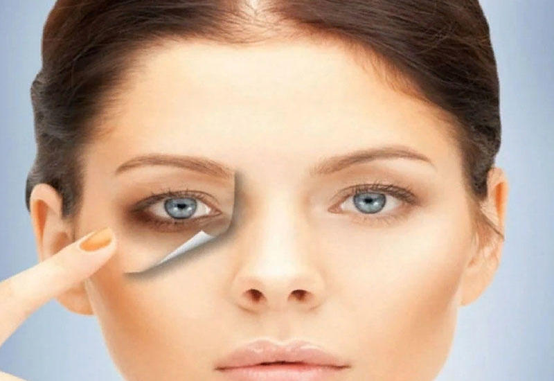 Gözaltı qaralmalar bu vitaminin əskikliyi ola bilər