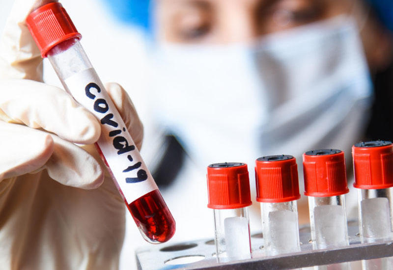 Когнитивные нарушения после COVID-19 являются одним из последствий любого вируса
